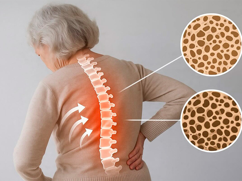 Rutinitas Sehari-hari yang Membantu Tulang Tetap Kuat dan Sehat